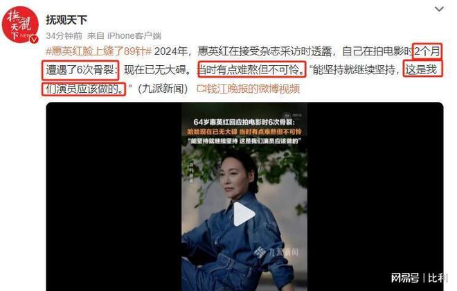 九游娱乐NineGame：脸上缝89针2个月骨裂6次惠英红的敬业打了多少流量明星的脸(图5)