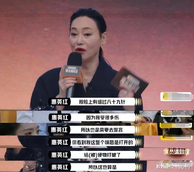 九游娱乐NineGame：脸上缝89针2个月骨裂6次惠英红的敬业打了多少流量明星的脸(图4)