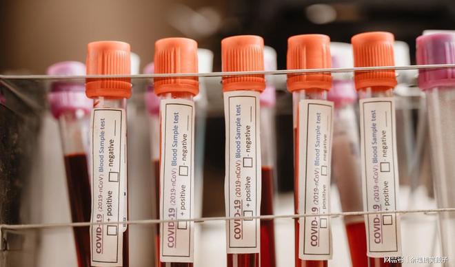 艾滋病增长趋势：医生提醒51岁以上人群注意外出防护(图5)